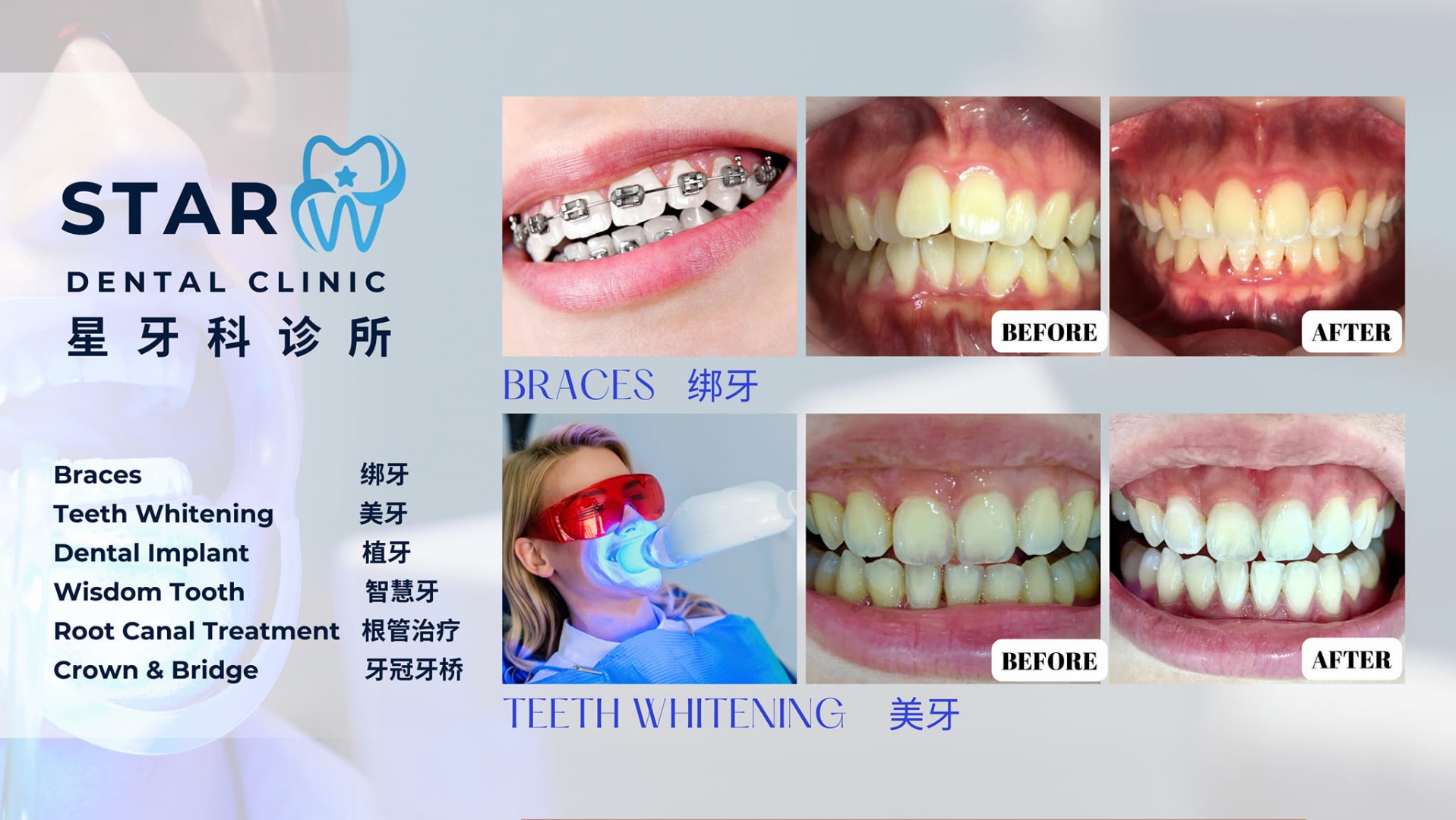 Star Dental Clinic Bukit Mertajam - Implant & Braces Centre 大山脚星牙科 种植牙和绑牙中心 — dental clinic in Malaysia
