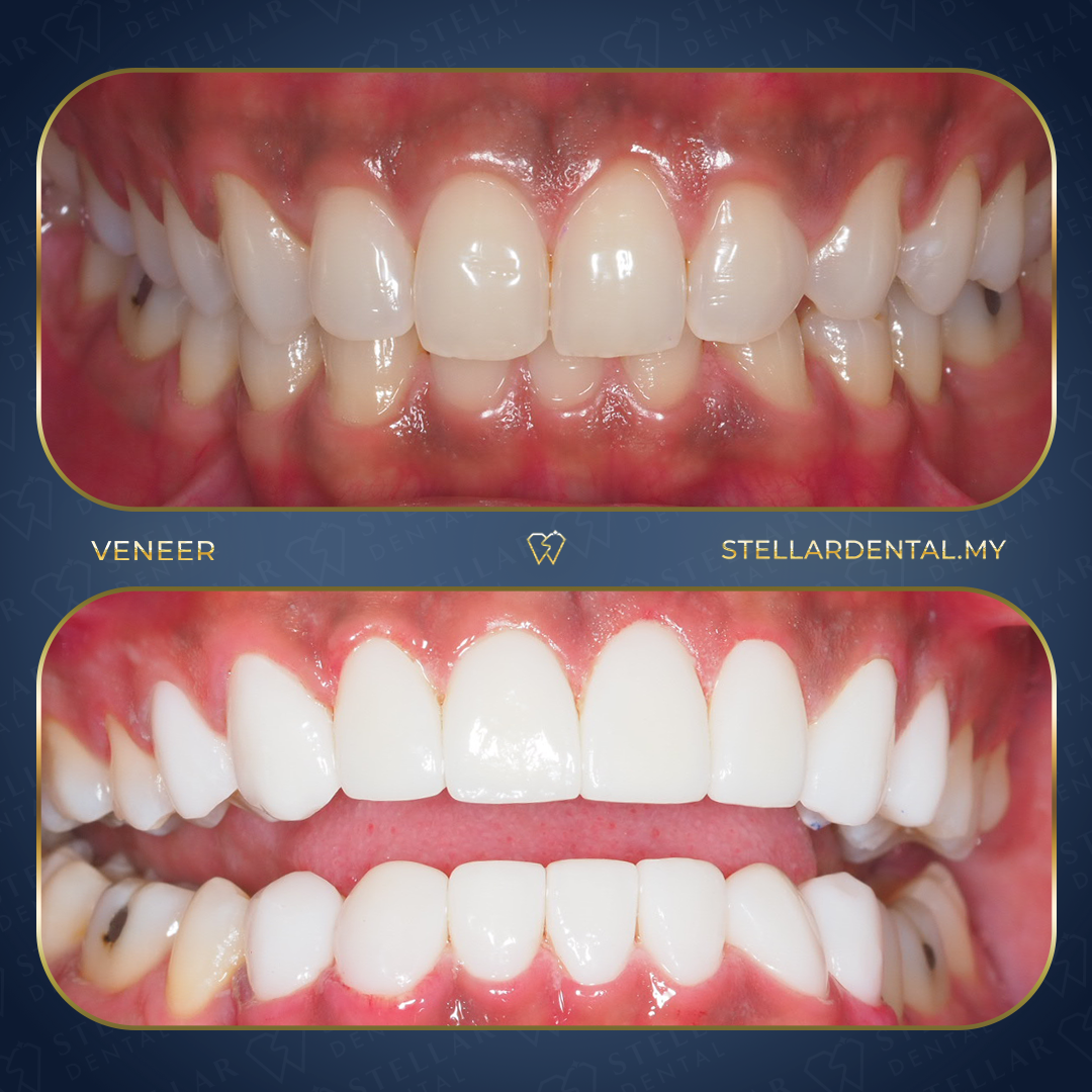 Stellar Dental Kota Damansara — photo 2