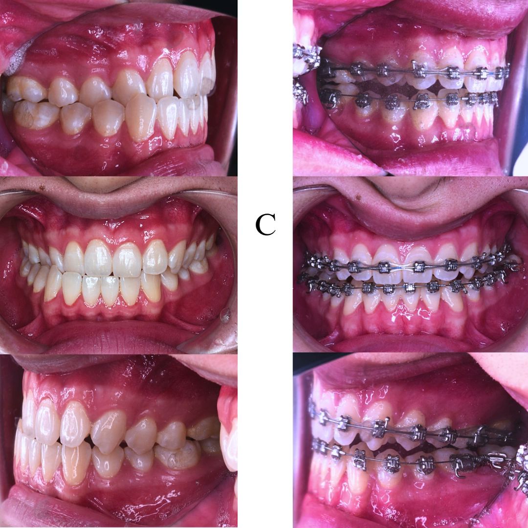 Subang Dental Specialist Clinic (HKO Dental Care SDN BHD) — photo 2