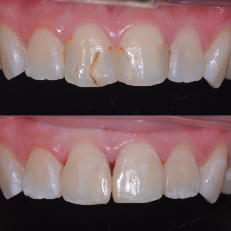 T-Care Dental Clinic Mutiara Mas Skudai — photo 3