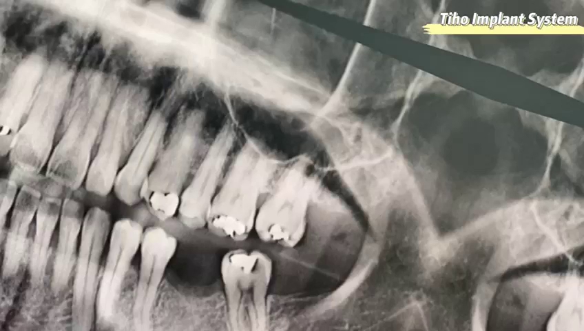 TIHO Dental Clinic KL (Open Everyday) | Dentist Kuala Lumpur | Klinik Gigi KL — photo 2