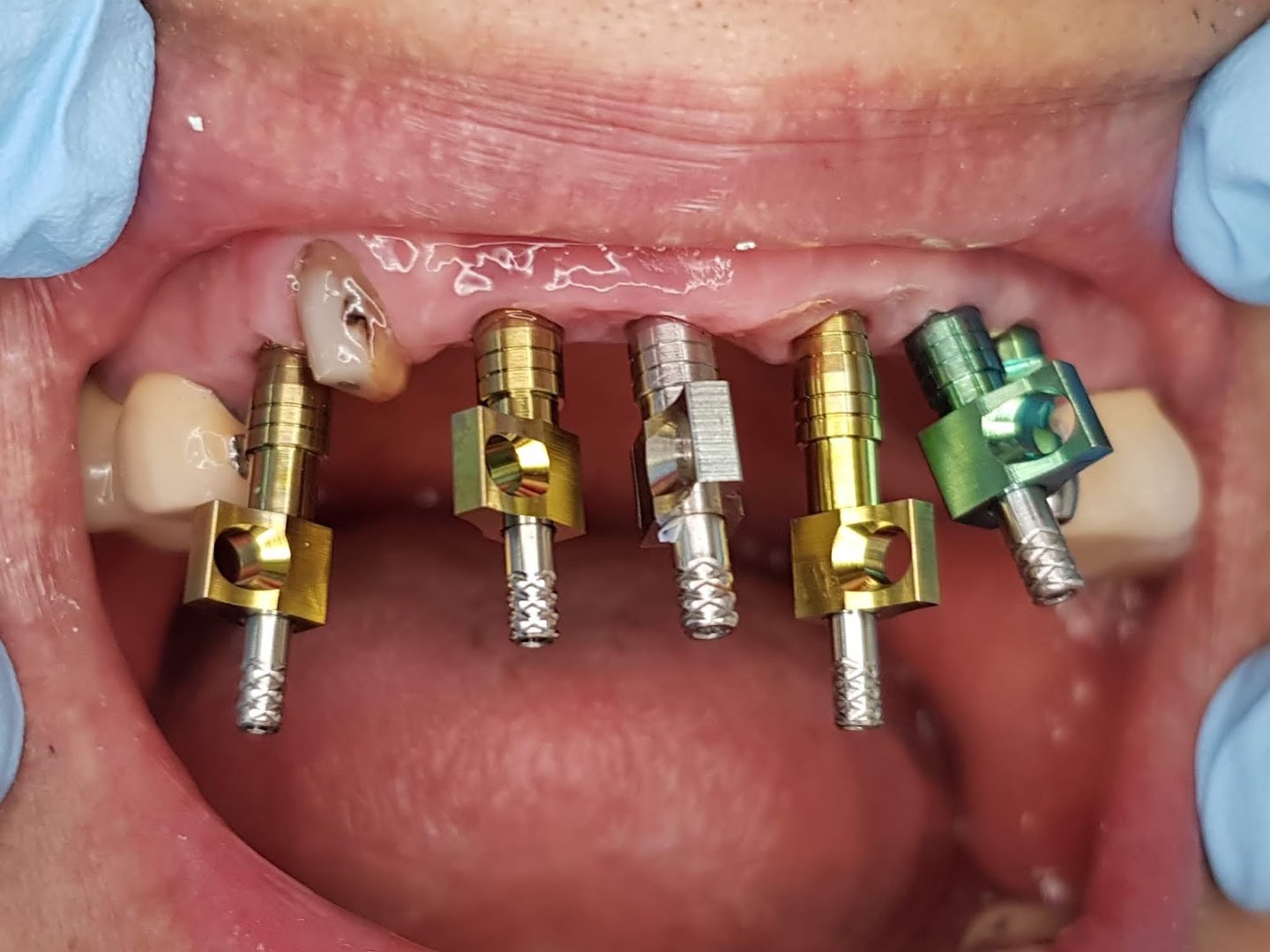 Tings' Dental Surgery 田氏牙科 — photo 2