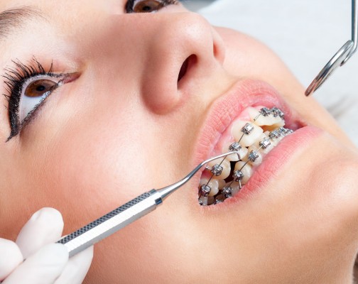 Tooth Works Dental Clinic Bandar Botanic (Braces, Implants & Invisalign) — dental clinic in Malaysia
