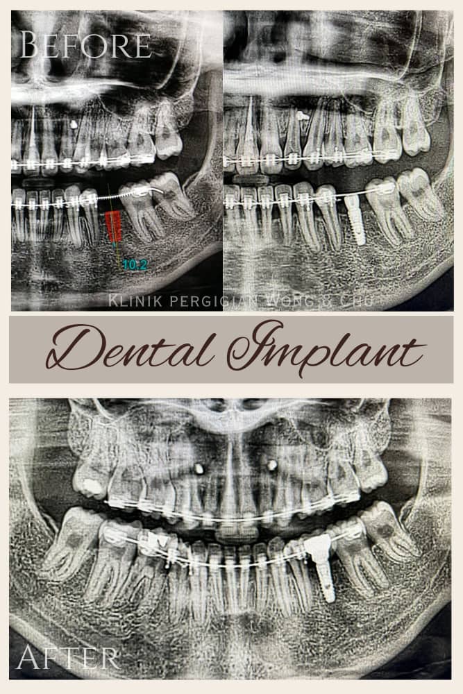 Wong & Chu Dental 黄朱牙科诊所 ( Invisalign, Implant, Surgery) — photo 2